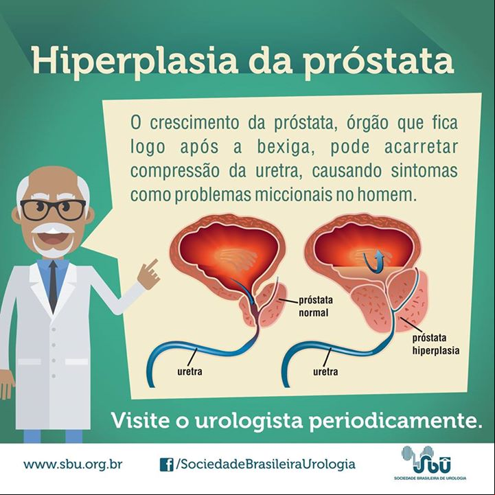 Próstata